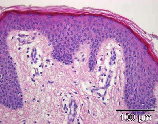 Grundlagen Funktion und Aufbau der Dermis Abb. 1.16 Arteriolen und Venolen sind im oberen und unteren Gefäßplexus der Haut zu finden.