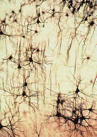 3.3 Neuroanatomische Methoden und Richtungs bezeichnungen Abbildung 3.11: Neuronales Gewebe, das mit der Golgi-Methode gefärbt wurde.