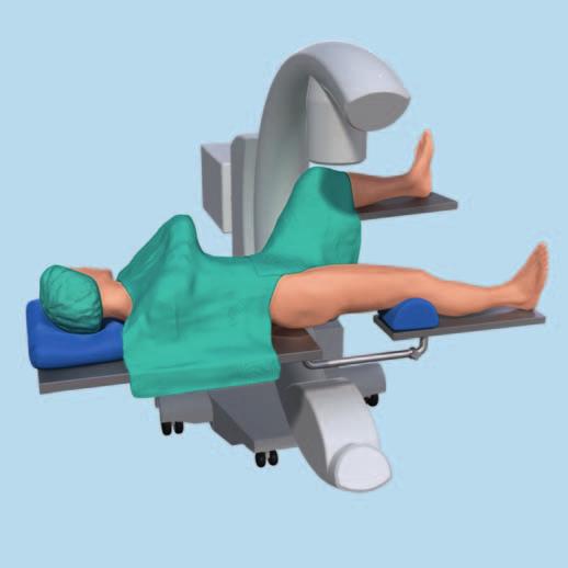 Lagerung des Patienten 1 Patientenlagerung Den Patienten in Rückenlage auf einen röntgenstrahlendurchlässigen OP-Tisch lagern. Das Bein sollte frei beweglich sein.