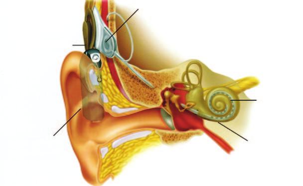 Cochlea-Implantat Ein Cochlea-Implantat (CI) ist eine Innenohr-Hörprothese. Sie ist für Patienten entwickelt worden, denen konventionelle Hörgeräte nicht mehr helfen oder die ertaubt sind.