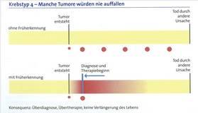 Krebstyp 4 Ü manche Tumore wärden nie auffallen Wie wird Nutzen belegt?