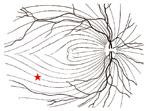 EINLEITUNG 21 Abb. 1.2: Nervenfasern (*) der Netzhaut. Abb. 1.3: Die Nervenfasern der Netzhaut verlassen das Auge durch den Sehnerv.