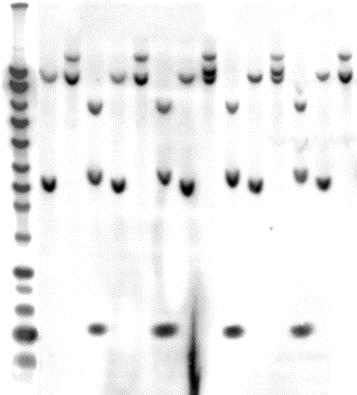 Abb. 2.1.2.2. Zellinie Raji Jurkat U937 Namalwa K562 kbp 10,00 8,00 6,00 5,00 4,00 3,00 2,50 2,00 1,50 1,00 0,80 0,60 0,40 0,20 27 M 1 2 3 4 5 6 7 8 9 10 11 12 13 14 Abb. 2.1..2.2.; Southernblotanalyse von genomischer DNA aus verschiedenen humanen Zellinien.