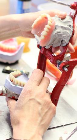 Attraktive Zähne mit Clear-Aligner Das Clear-Aligner-System verhilft den Patienten auf nahezu unsichtbare und komfortable Weise zu einer attraktiven Zahnstellung.