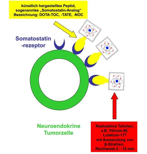 Neuroendokrine Tumore Expression von Somatostatinrezeptoren (SSTR) z.