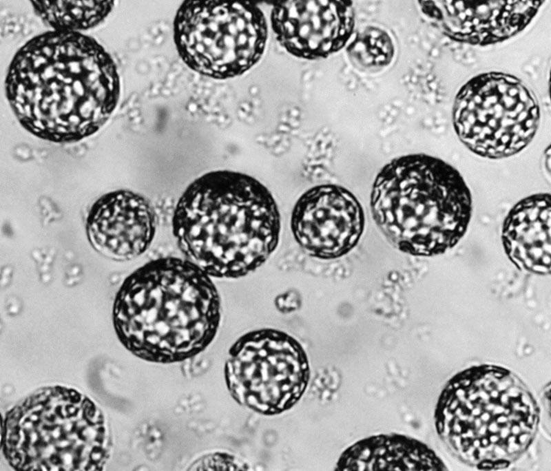 Cytoskelett Das Cytoskelett ist für die Formgebung pflanzlicher Zellen weniger wichtig als in tierischen Zellen, da es außerdem noch Zellwände gibt, die vor allem für die Form