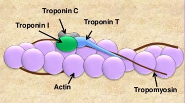 Strukturproteine Kardiale Troponine liegen in drei Proteinkomplexen vor: TnC: Bindung an Kalzium TnT: Bindung an Tropomyosin