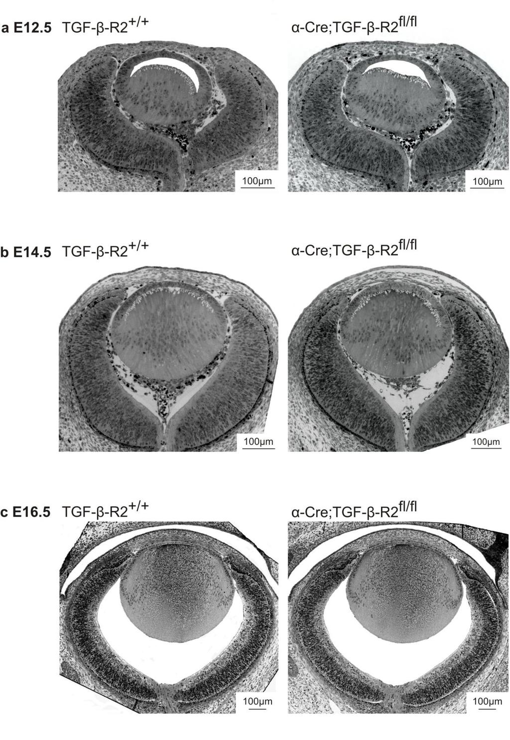 III. ERGEBNISSE 44 Abbildung 6: Phänotyp α-cre;tgf-β-r2 fl/fl Panoramaaufnahmen von Wildtyp und
