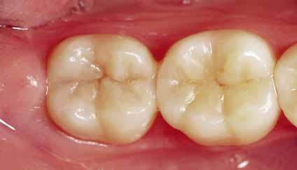 Die Anatomie und die Funktion der Zähne wurde