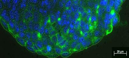Nestin, ein Protein von neuronalen Vorläuferzellen, in die Studie miteinbezogen.