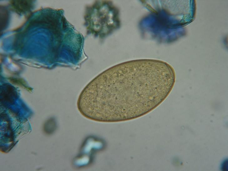 Diagnostik Fleischschau Einachweis im Kot Serologie Diagnostik Fleischschau Einachweis im Kot Serologie Standardmethode - Eiausscheidung