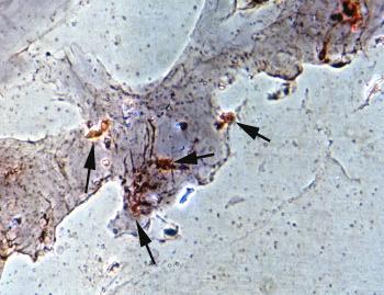 Abb. 43: Vermehrte Proliferation von Fibroblasten auf der Oberfläche eines Gelatineschaumes