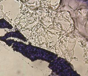 % EDAC) nach 7 Tagen Inkubation: Fibroblasten- Schicht auf dem Gelatineschaum ( ),