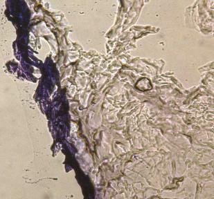 Abb. 35: Verstärkter Zerfall des Gelatineschaums (0,07 Gew.% EDAC) nach 14 Tagen Inkubation ( ) Vergrößerung unter dem Mikroskop: 20 x 12,5 In den Abb.