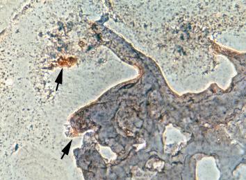 Abb. 41: Diskrete Proliferation von Fibroblasten ins Innere eines Gelatineschaums (5 Gew.% EDAC) nach 11 Tagen Inkubation Vergrößerung unter dem Mikroskop: 20 x 12,5.