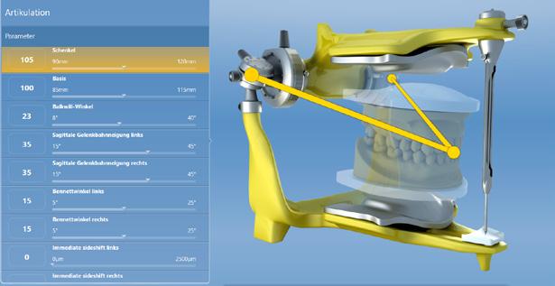 PROGRAMMIERUNG DES VIRTUELLEN ARTIKULATORS IN CEREC SICAT FUNCTION ERMÖGLICHT erstmals die Ermittlung aller