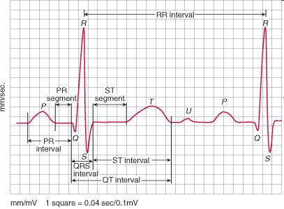 QT-Intervall - EKG-Auswertung Dauer der QT-Zeit ändert sich mit altersabhängiger Ruhefrequenz frequenzkorrigierte QT-Zeit (QTc) am häufigsten: Korrekturformel nach Bazett (Frequenzbereich 60-80/min),