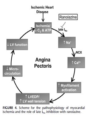 A Novel Mechanism for the Treatment of Angina, Arrhythmias, and Diastolic Dysfunction: Inhibition of Late INa Using Ranolazine BNP L.