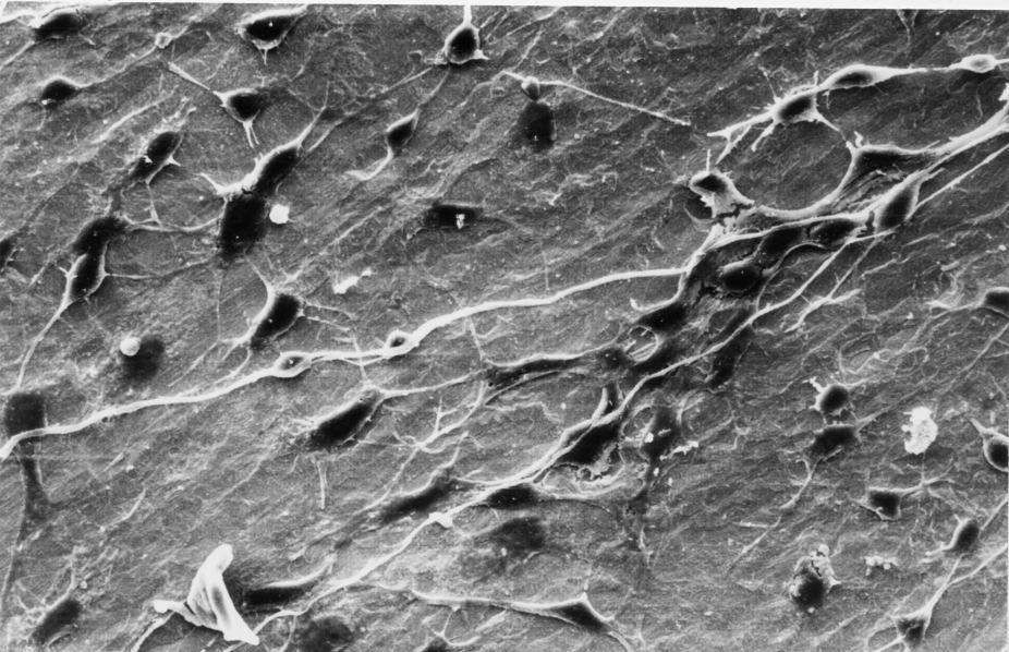 Die weißen Pfeile deuten auf eng an den Neuriten anliegende Zellen, die glialen Ursprungs sein könnten.