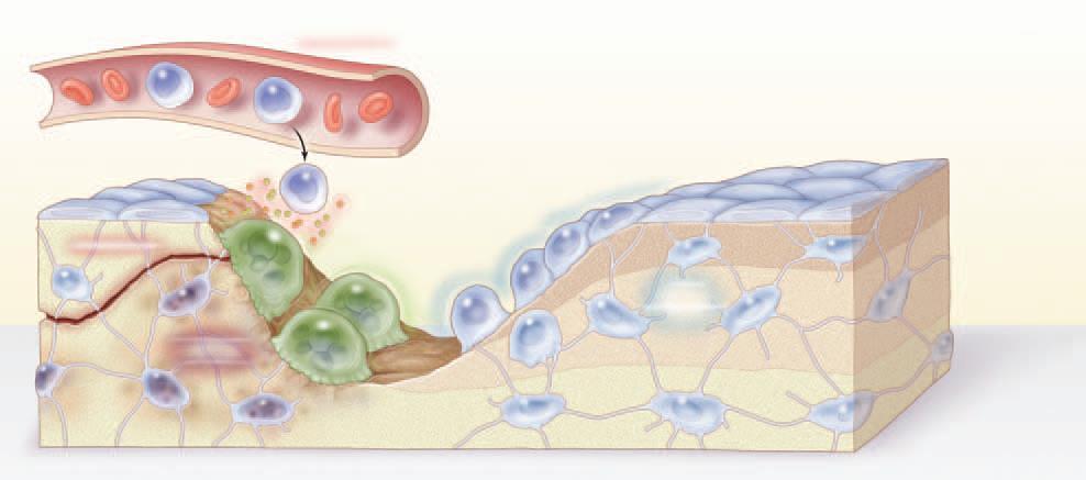 Bone remodeling (Knochen Umbau) normaler Umbau hoher Umbau Seeman NEJM 