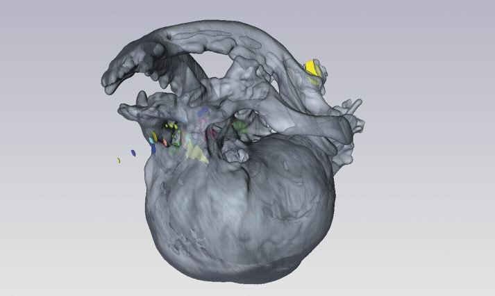 Transparentes 3-D-Computermodell des Schädels eines Mopses. benden Begriffen brachycephal, mesocephal (mittellange Kopfform/ Norm ) oder dolichocephal (lange Kopfform) zugeordnet wurden.
