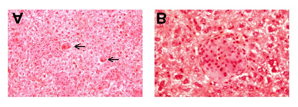 Dargestellt sind Leberschnitte in ZN-Färbung in 400-facher Vergrößerung 3 Wochen (Bild A und B) und 8 Wochen (Bild C und D) nach Infektion. Abb.