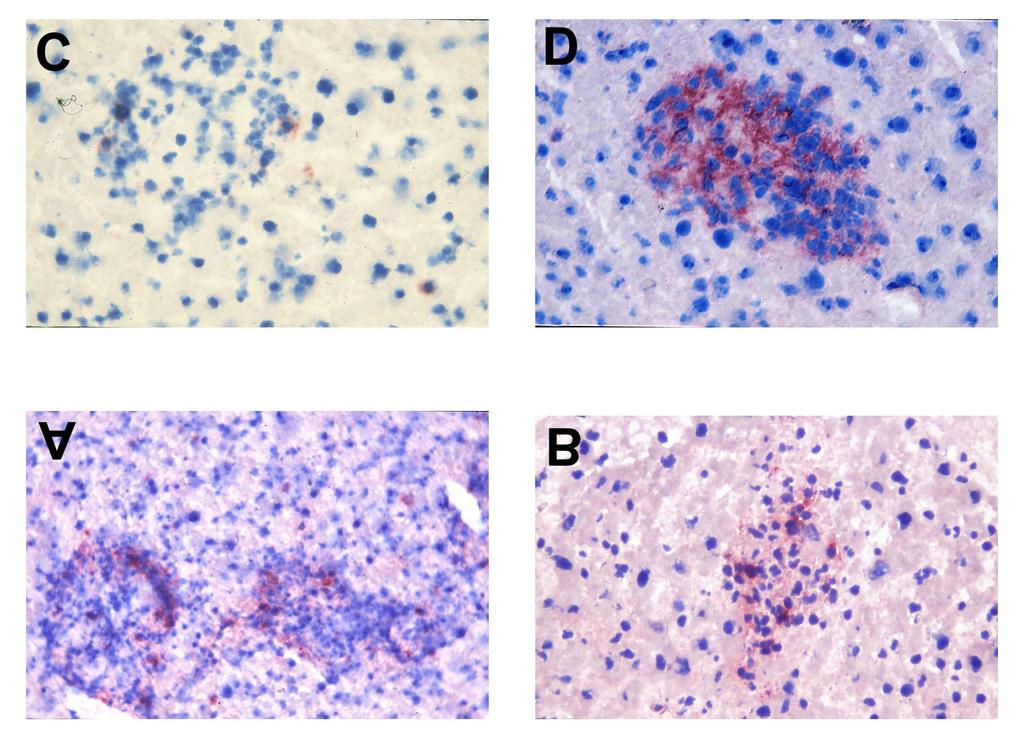 36 3.1.4.3. Identifikation der im Granulom befindlichen Zellen (Abb. 6) Die Granulome nach Infektion mit M.avium waren typisch aufgebaut.
