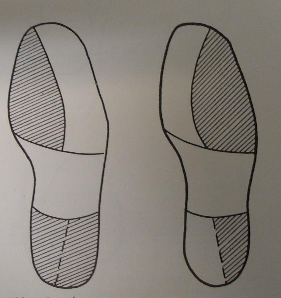 Indikationen: Schuhranderhöhungen medial/lateral Arthrose im oberen oder unteren Sprunggelenk, Fußwurzelartrose, Veränderungen
