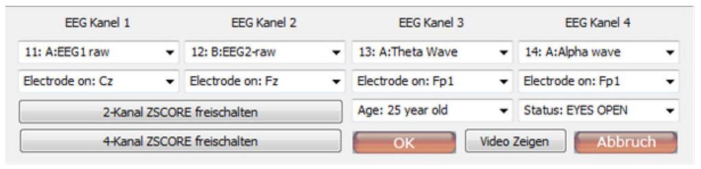 2. Z-score 4-Kanal Der 4-Kanal Z-Score ermöglicht sowohl ein Training von bis zu 4 individuellen Stellen der Kopfhaut als auch eine Verknüpfung dieser Stellen.