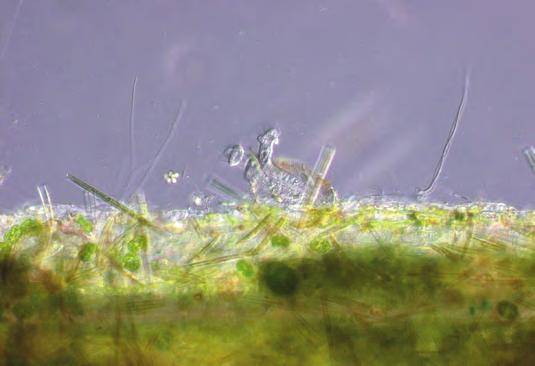 Abb. 28: Der Zooflagellat Codosiga auf
