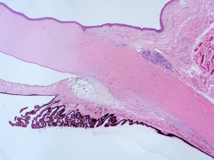 Tunica vasculosa: Corpus ciliare Ernst