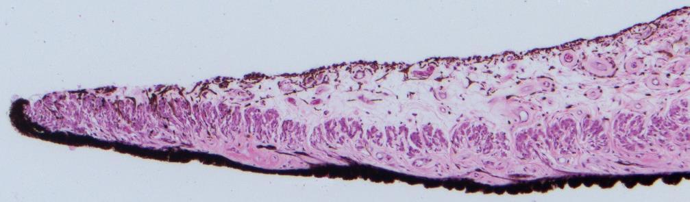 Tunica vasculosa: Iris 1.