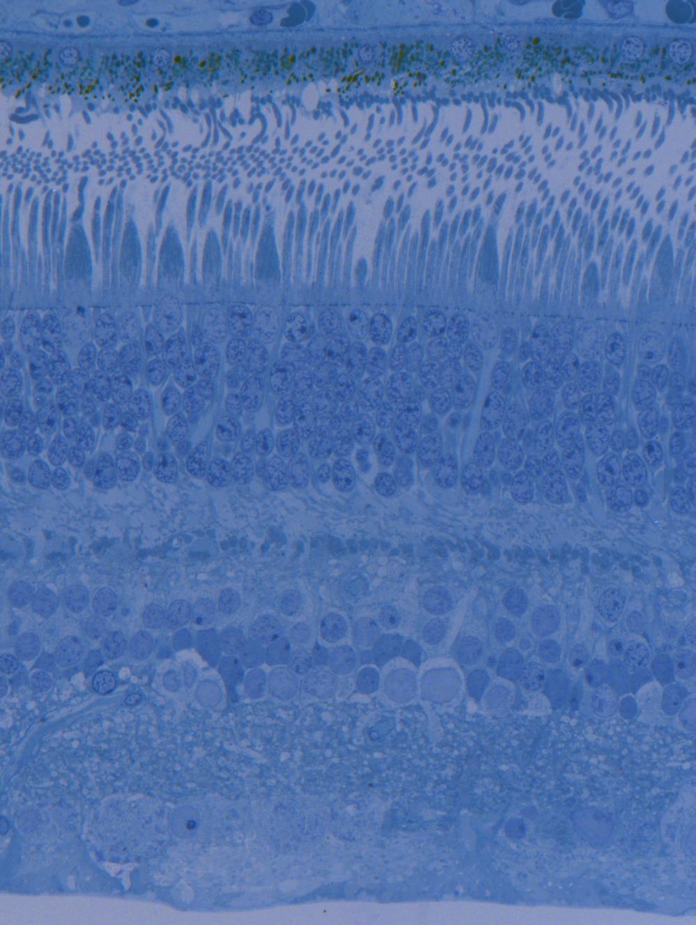 Pars optica retinae Pigmentepithel Str. neuroepiheliale (Außensegmente) Str. neuroepiheliale (Innensegmente) Membrana limitans ext. Str. granulosum ext.