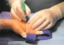 Der Unfallchirurg muss deshalb mit allen wesentlichen anatomischen, diagnostischen und therapeutischen Aspekten der Hand vertraut sein.