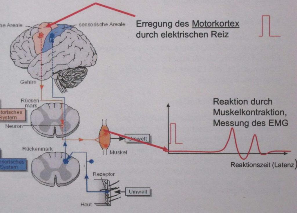 Motorisch evozierte Potentiale > Elektrische Stimulation einer Nervenzelle > Ableitung der Antwortpotentiale in