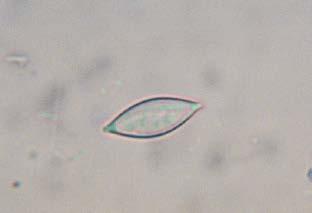 Regenwurmborsten nachgewiesen wurden 100 µm Mikroskopvergrößerung