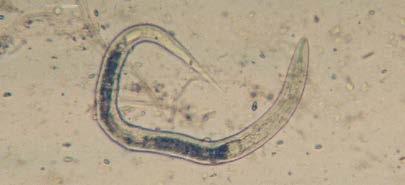 Zwergfadenwurm Darmpassanten Ballaststoffe 121 5.6 Zwergfadenwurm (Strongyloides sp.) Gelegentlich findet man die Larven des Zwergfadenwurm Strongyloides im Igelkot.