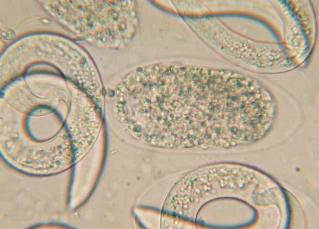der Ei-Hülle Bild 2 100 µm Mikroskopvergrößerung