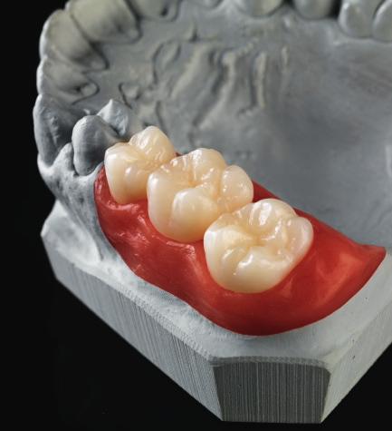 Der neue Sinterofen Ceramill Therm 3 bietet hierfür abgestimmte, bereits vorprogrammierte thermische Abläufe.