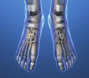 Fußchirurgie Die Anatomie und Architektur unserer Füße ist komplex Ziel der modernen Fußchirurgie ist es, einen belastbaren, schmerzfreien und kosmetisch ansprechenden Fuß wiederherzustellen In