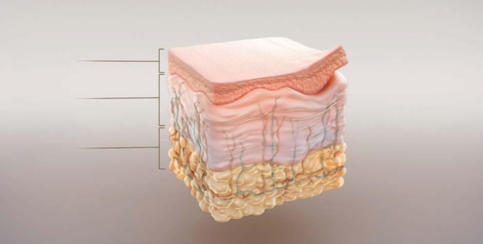 Die der epidermalen Hauttransplantation zu Grunde liegenden wissenschaftlichen Erkenntnisse Die Vorteile der epidermalen Hauttransplantation Epidermale Micrografts unterscheiden sich von Vollhaut-