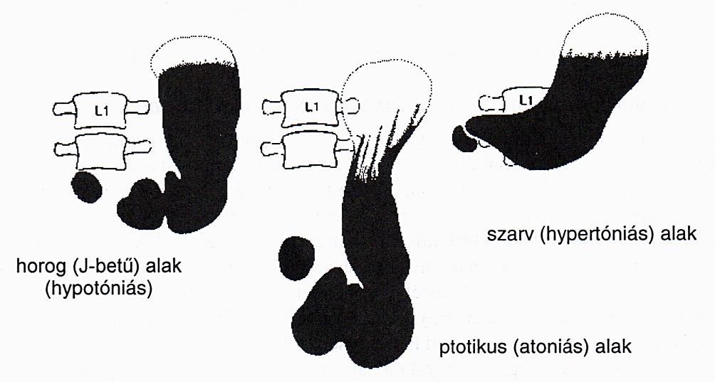 einer aufrechten Position; Fundus mit Gas gefüllt) stehend oder nach Th10/11 eine Höhe der linken Seite der Wirbelsäule