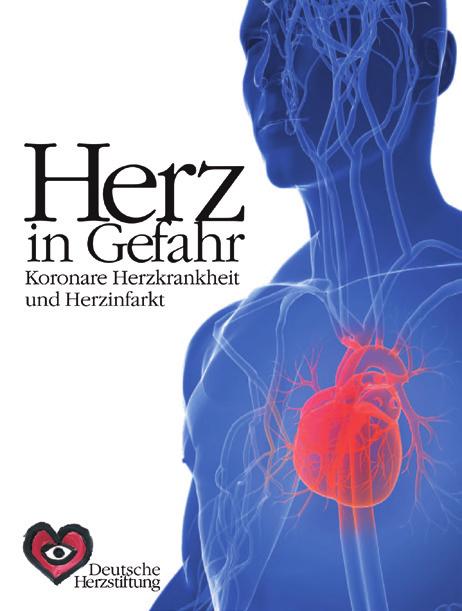 Expertenratgeber bestellen Broschüre Herz in Gefahr mit ausführlichen Informationen über die heutige Behandlung der koronaren Herzkrankheit und des Herzinfarkts.