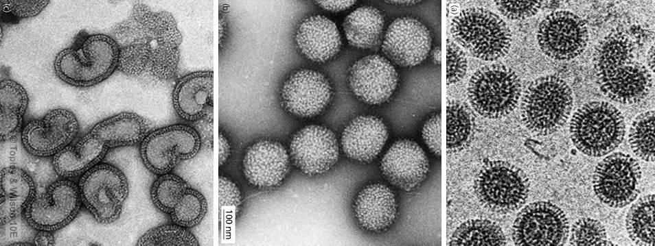 Influenzaviren mit Eindringen Negativfärbung ohne