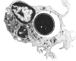 Phagozyten: Intrazelluäre Abtötung von Pilzsporen Vakuole NADPH Oxidase Pilz-Spore Vakuole O 2 Microbe ROS - O 2