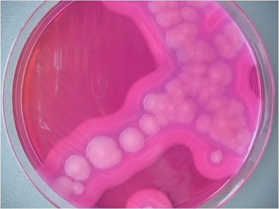 Bacillus cereus Min. Konzentration: Ca. 100.000 KbE/g (Bildung eines hitzestabilen Erbrechen-Toxins im Lebensmittel bzw.