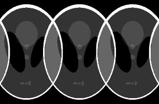Ist der Abstand der Linien im k-raum klein genug und damit das Bildfeld größer als das Objekt (rechts, L b > Objekt), dann wird das Bild ohne Einfaltungen dargestellt.