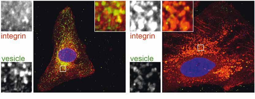 26 RESEARCH REPORT FORSCHUNGSBERICHT 2013 / 2014 integrin vesical CONTROL CELL integrin vesical LOSS OF MTM1 Fig.