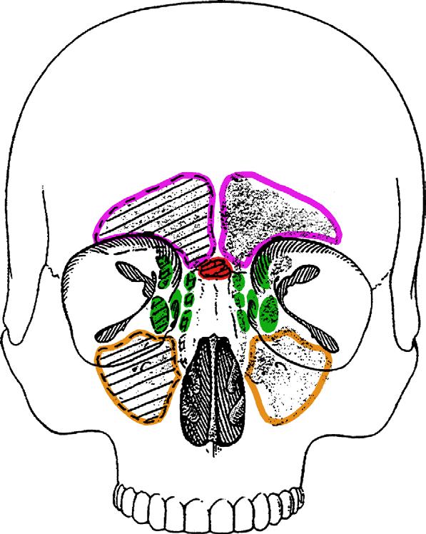Nasennebenhöhlen Pneumatisierte (Resonanz)Räume Sinus frontalis (Stirnhöhle) im Os frontale (Stirnbein), im Parasagittalschnitt L-förmig Sinus sphenoidalis (Keilbeinhöhle) im Körper des Os