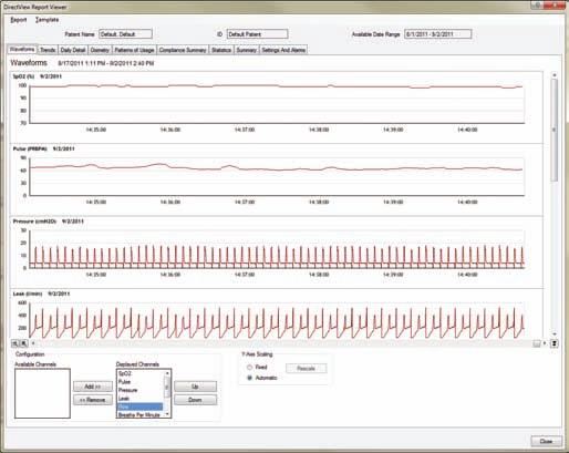 Mit dem Philips Respironics OximetrieModul können die Pulsraten-und SpO2-Daten in Verbindung mit anderen Parametern der Therapie sowohl graphisch als auch statistisch